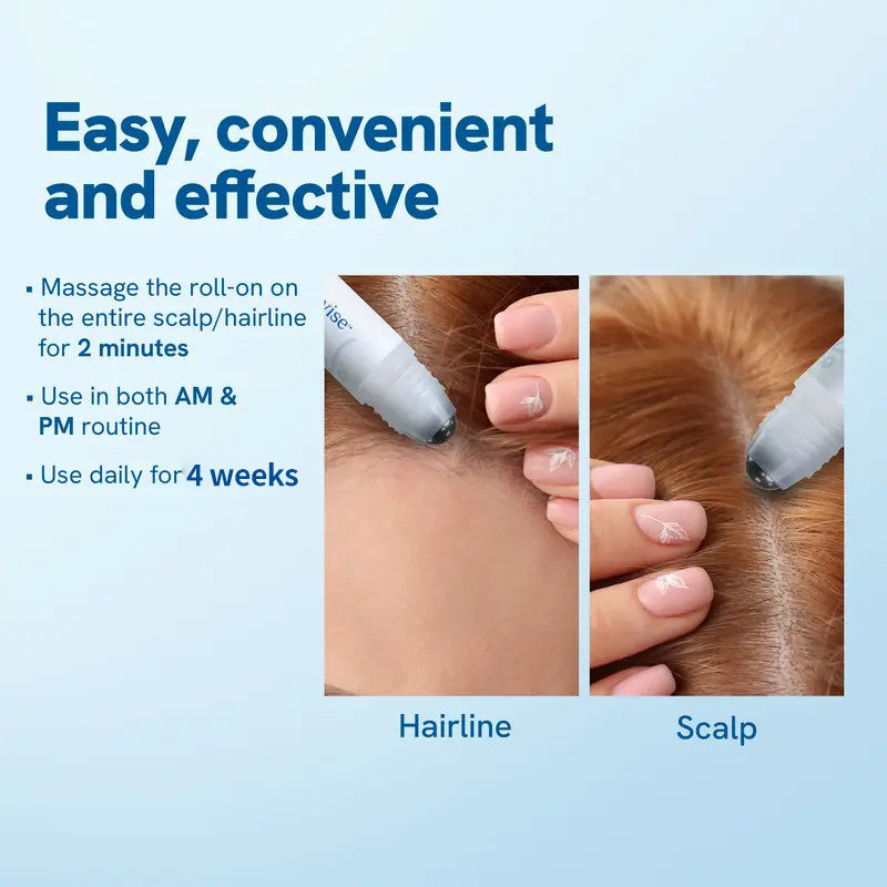 Slimoly™ Advanced Anti-Hair Loss Roll-On – See hair growth in 4 weeks