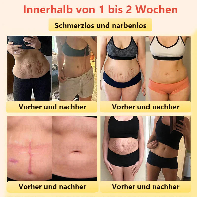 Histone™ Medizinische Grad Titanfaser Selbstheizende Turmalin Forming Shorts👙