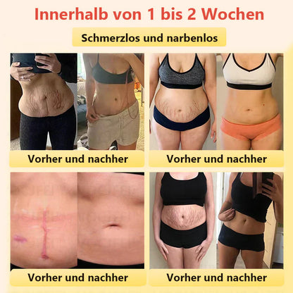 Histone™ Medizinische Grad Titanfaser Selbstheizende Turmalin Forming Shorts👙
