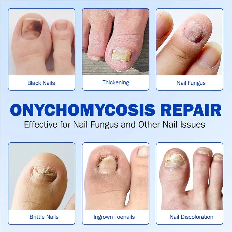 Up to 65% OFF!🔥Nail Health Care Patches – Repair and Strengthen Weak Nails
