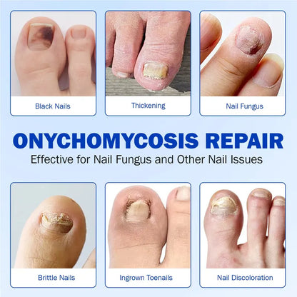 Up to 65% OFF!🔥Nail Health Care Patches – Repair and Strengthen Weak Nails